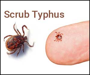 Scrub-Typhus